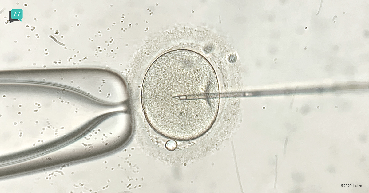 infertility treatment options In Vitro Fertilization IVF halza digital health