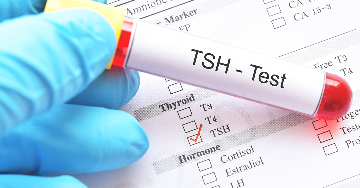 blood test thyroid function test diagnosing thyroid disorder halza digital health